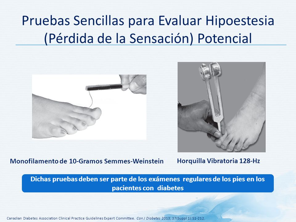 Pruebas Sencillas para Evaluar Hipoestesia (Pérdida de la Sensación) Potencial