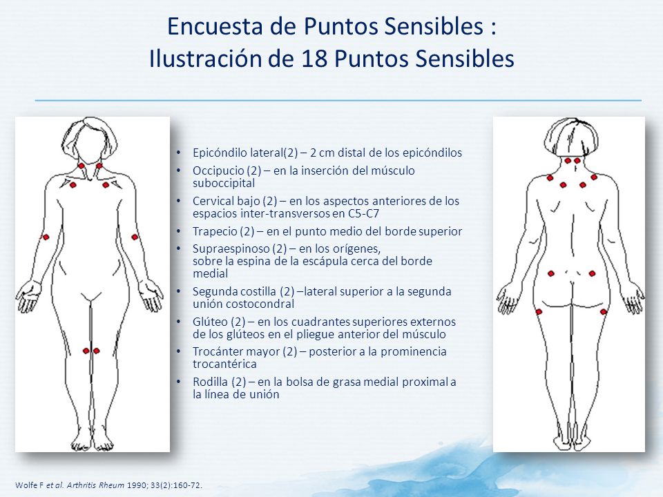 Encuesta de Puntos Sensibles : Ilustración de 18 Puntos Sensibles