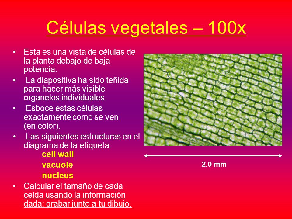 Células vegetales – 100x Esta es una vista de células de la planta debajo de baja potencia.