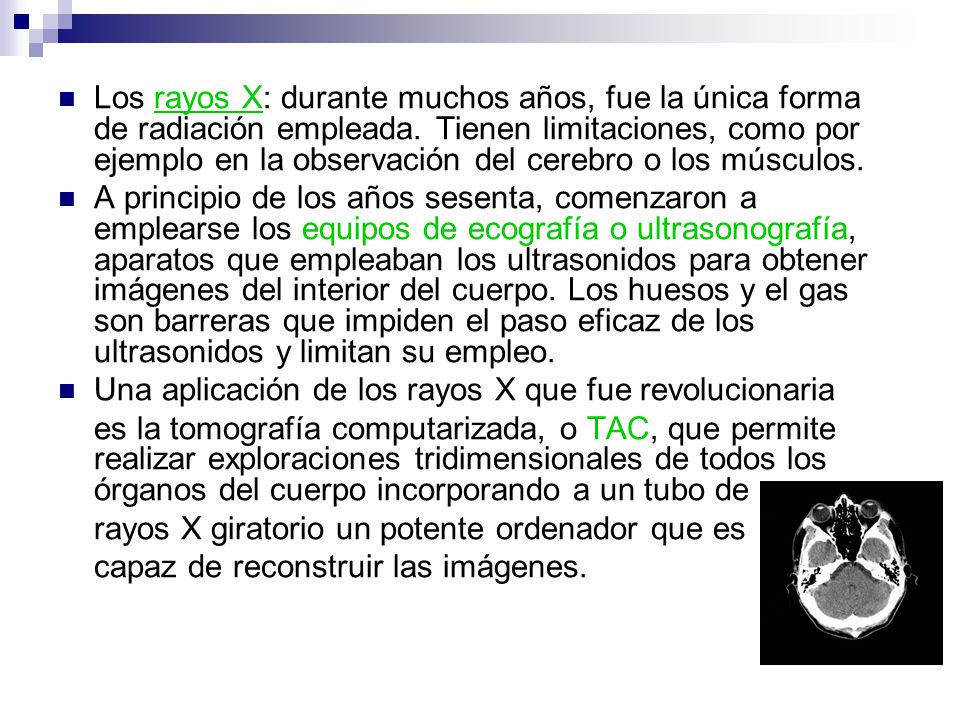 Los rayos X: durante muchos años, fue la única forma de radiación empleada. Tienen limitaciones, como por ejemplo en la observación del cerebro o los músculos.