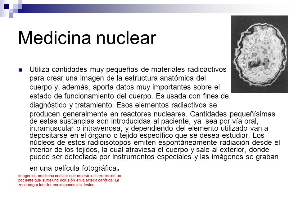 Medicina nuclear Utiliza cantidades muy pequeñas de materiales radioactivos. para crear una imagen de la estructura anatómica del.