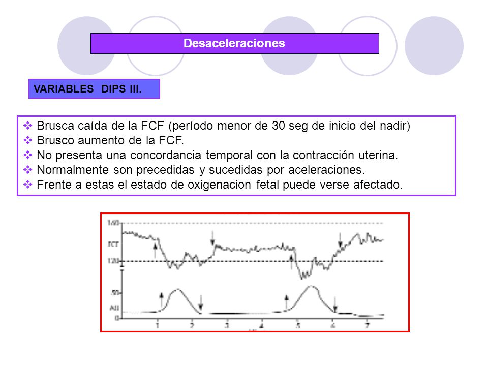 Brusca caída de la FCF (período menor de 30 seg de inicio del nadir)