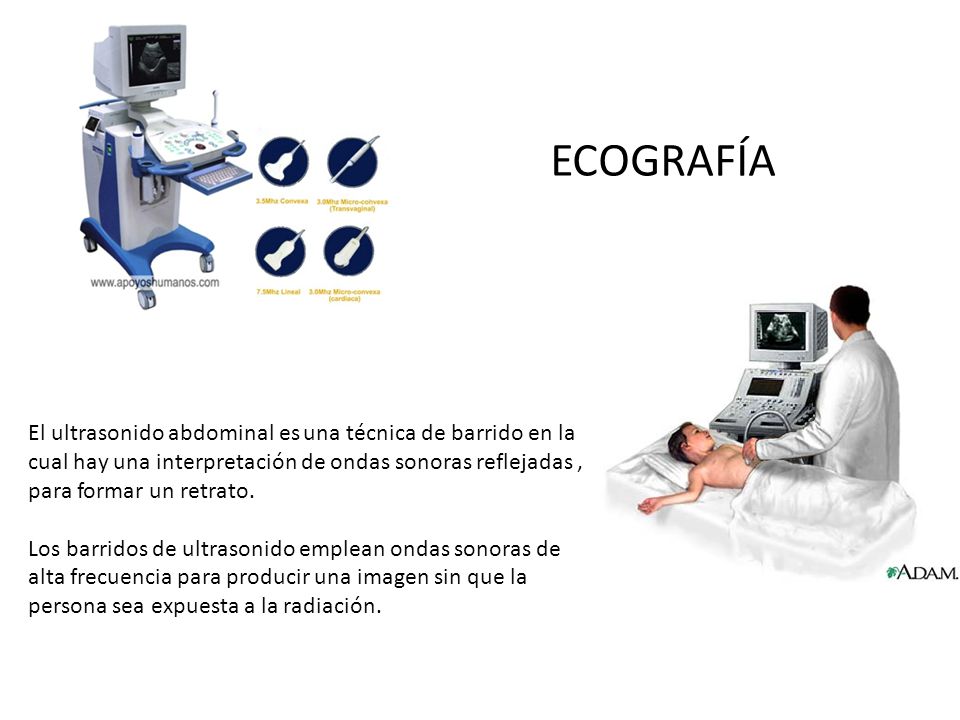 ECOGRAFÍA El ultrasonido abdominal es una técnica de barrido en la cual hay una interpretación de ondas sonoras reflejadas , para formar un retrato.