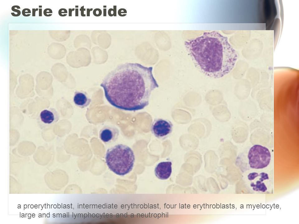 Serie eritroide a proerythroblast, intermediate erythroblast, four late erythroblasts, a myelocyte,