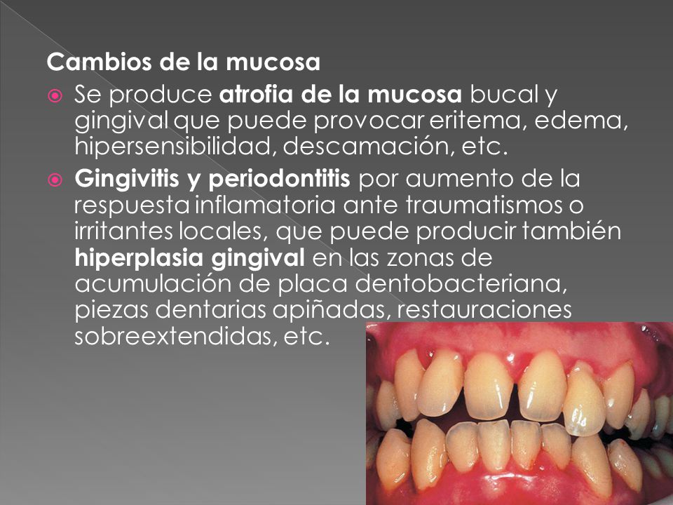 Cambios de la mucosa Se produce atrofia de la mucosa bucal y gingival que puede provocar eritema, edema, hipersensibilidad, descamación, etc.