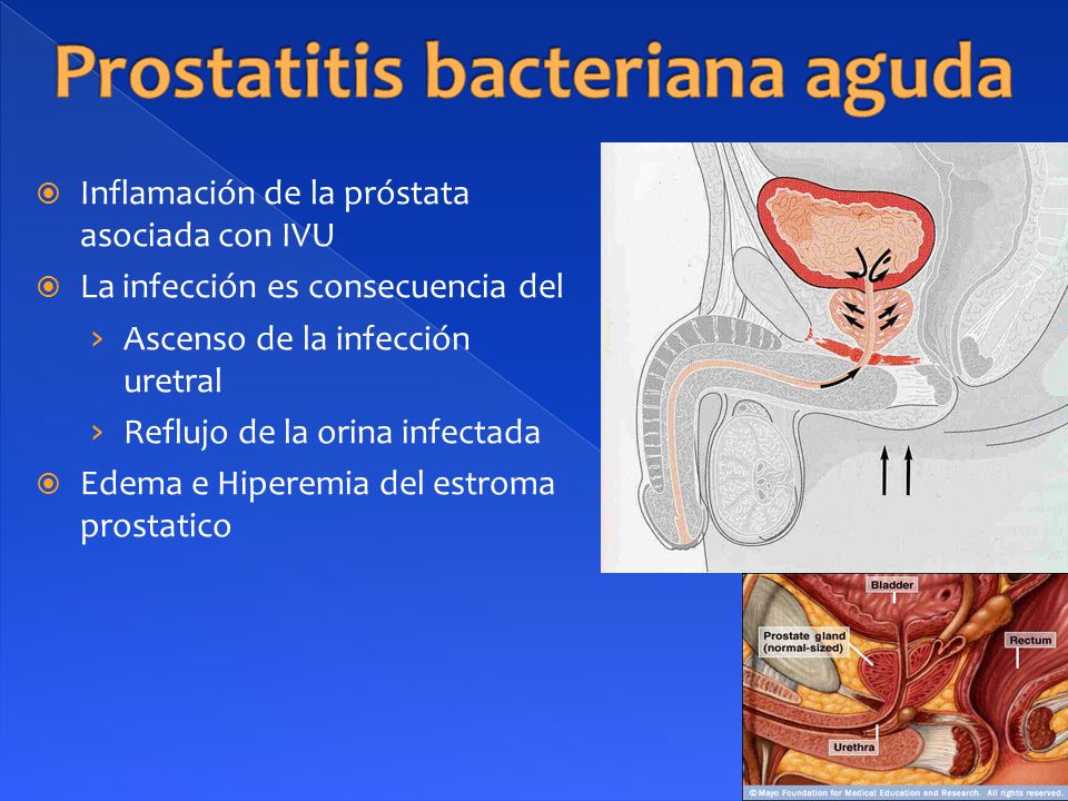 Urologia PDF | PDF