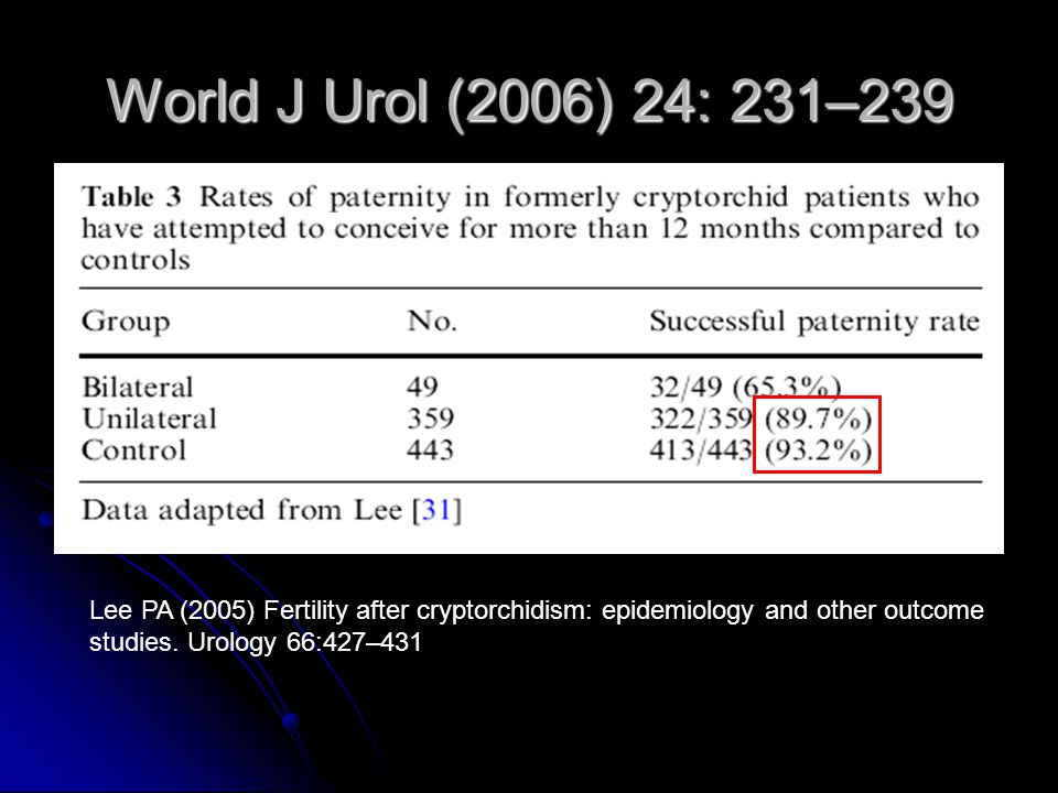World J Urol (2006) 24: 231–239 Lee PA (2005) Fertility after cryptorchidism: epidemiology and other outcome studies.