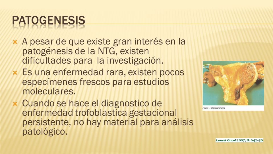 Patogenesis A pesar de que existe gran interés en la patogénesis de la NTG, existen dificultades para la investigación.