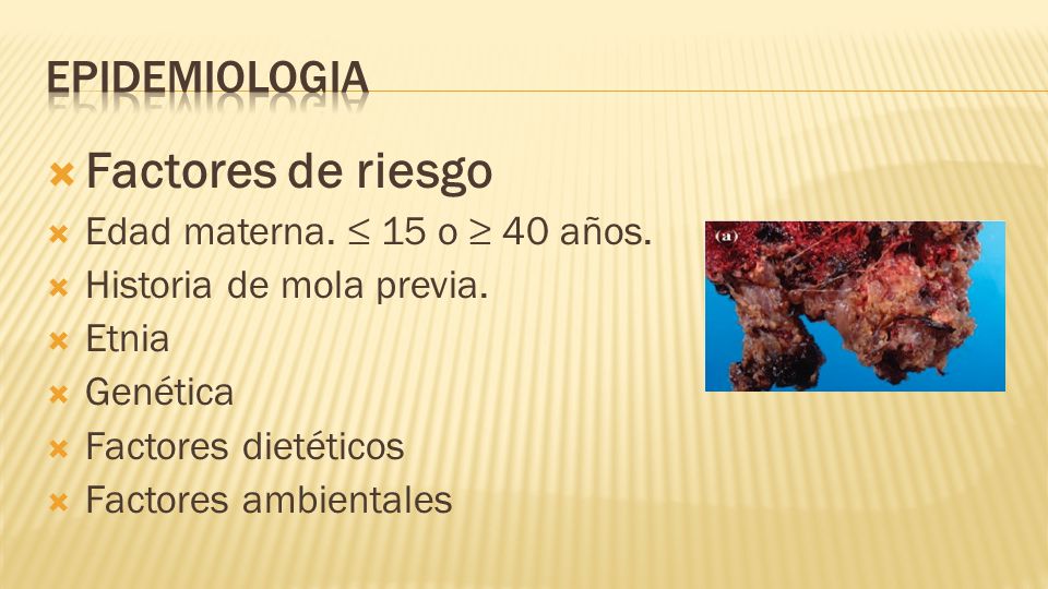 Factores de riesgo epidemiologia Edad materna. ≤ 15 o ≥ 40 años.