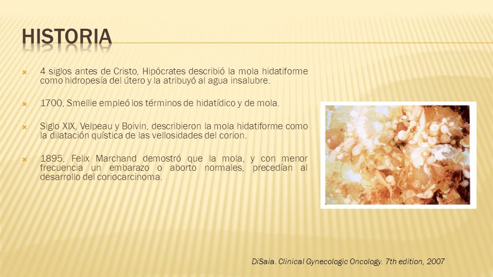 Historia 4 siglos antes de Cristo, Hipócrates describió la mola hidatiforme como hidropesía del útero y la atribuyó al agua insalubre.