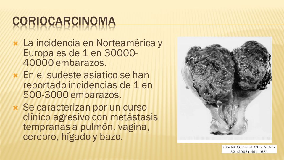 Coriocarcinoma La incidencia en Norteamérica y Europa es de 1 en embarazos.