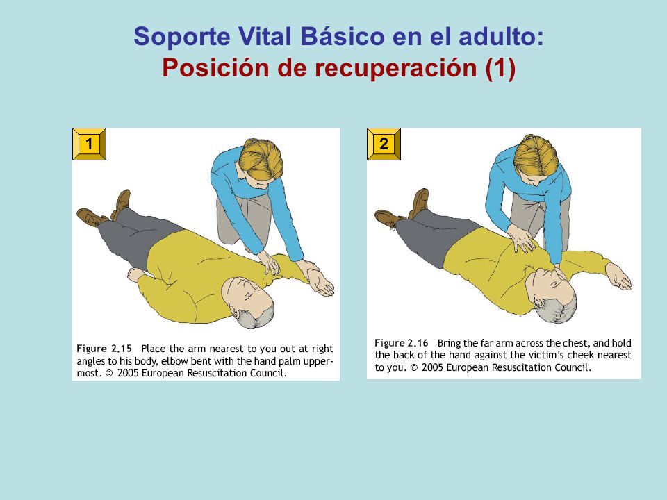 Soporte Vital Básico en el adulto: Posición de recuperación (1)