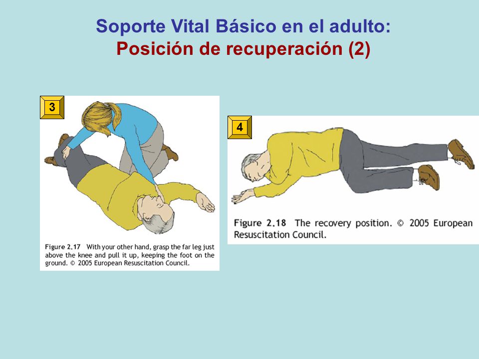 Soporte Vital Básico en el adulto: Posición de recuperación (2)