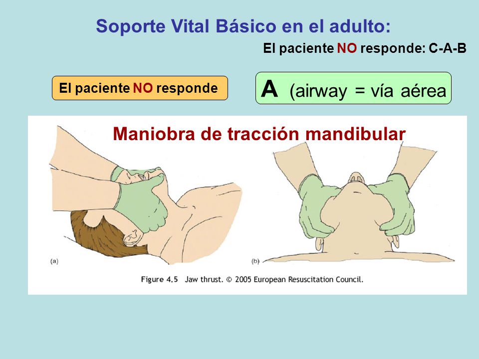 A (airway = vía aérea Soporte Vital Básico en el adulto:
