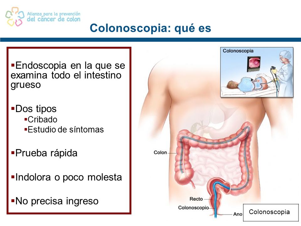 Colonoscopia: qué es Endoscopia en la que se examina todo el intestino grueso. Dos tipos. Cribado.