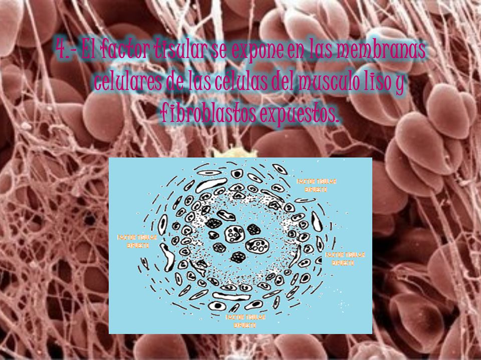 4.- El factor tisular se expone en las membranas celulares de las células del musculo liso y fibroblastos expuestos.