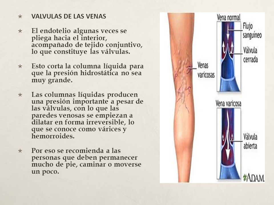 VALVULAS DE LAS VENAS El endotelio algunas veces se pliega hacia el interior, acompañado de tejido conjuntivo, lo que constituye las válvulas.