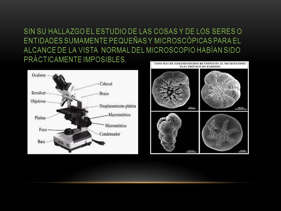 Sin su hallazgo el estudio de las cosas y de los seres o entidades sumamente pequeñas y microscópicas para el alcance de la vista normal del microscopio habían sido prácticamente imposibles.