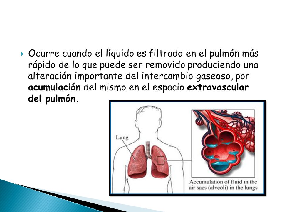 Ocurre cuando el líquido es filtrado en el pulmón más rápido de lo que puede ser removido produciendo una alteración importante del intercambio gaseoso, por acumulación del mismo en el espacio extravascular del pulmón.