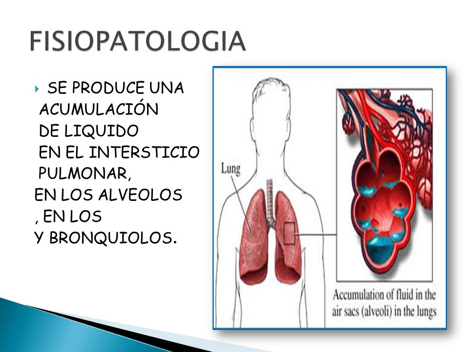 FISIOPATOLOGIA SE PRODUCE UNA ACUMULACIÓN DE LIQUIDO EN EL INTERSTICIO