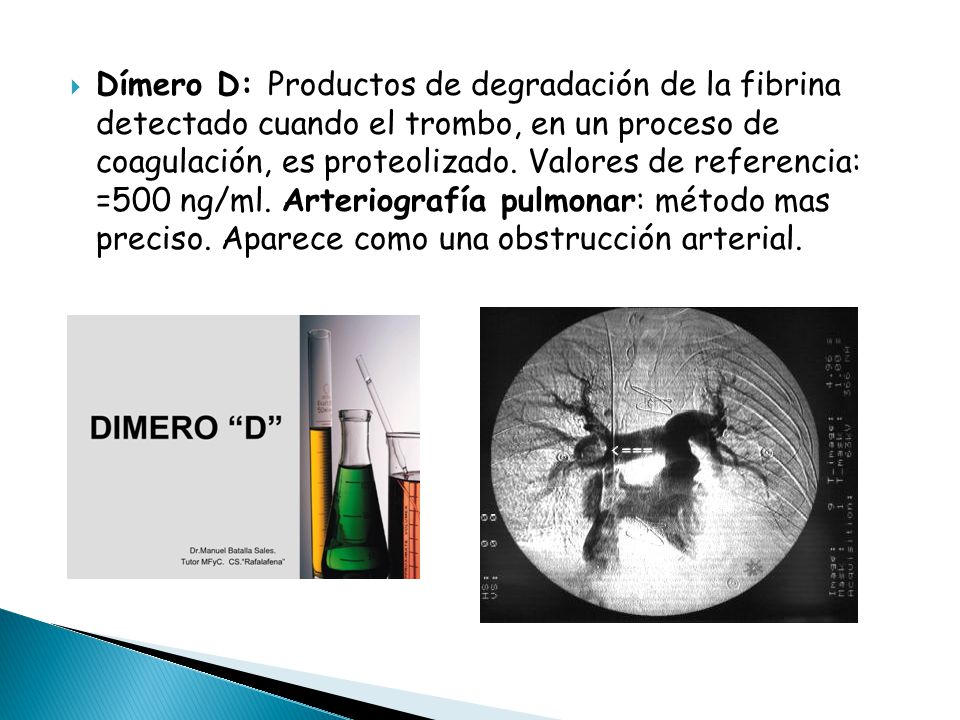 Dímero D: Productos de degradación de la fibrina detectado cuando el trombo, en un proceso de coagulación, es proteolizado.
