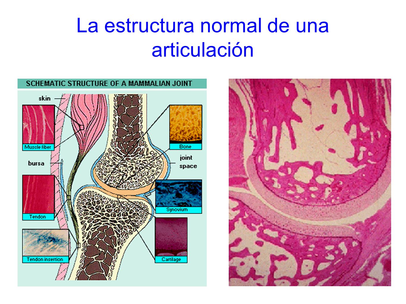 La estructura normal de una articulación
