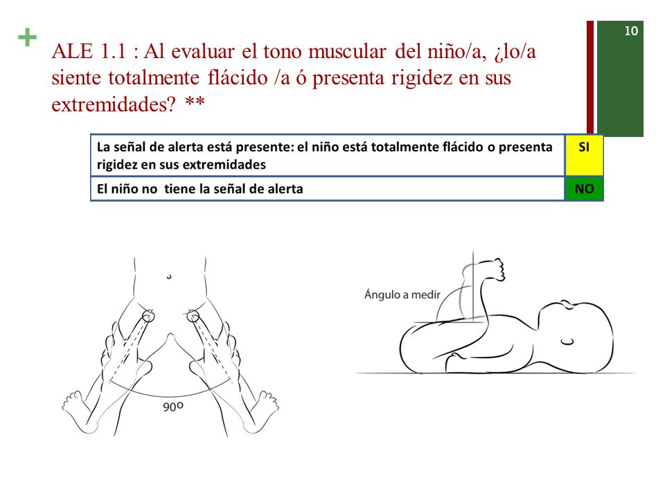 ALE 1.1 : Al evaluar el tono muscular del niño/a, ¿lo/a siente totalmente flácido /a ó presenta rigidez en sus extremidades.