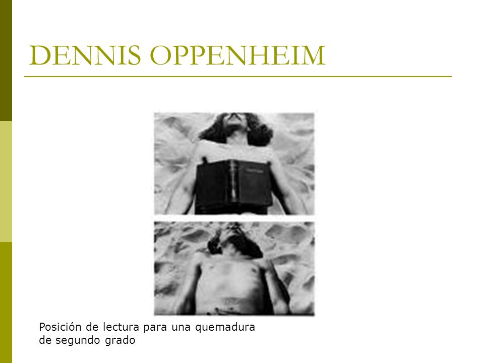 DENNIS OPPENHEIM Posición de lectura para una quemadura de segundo grado