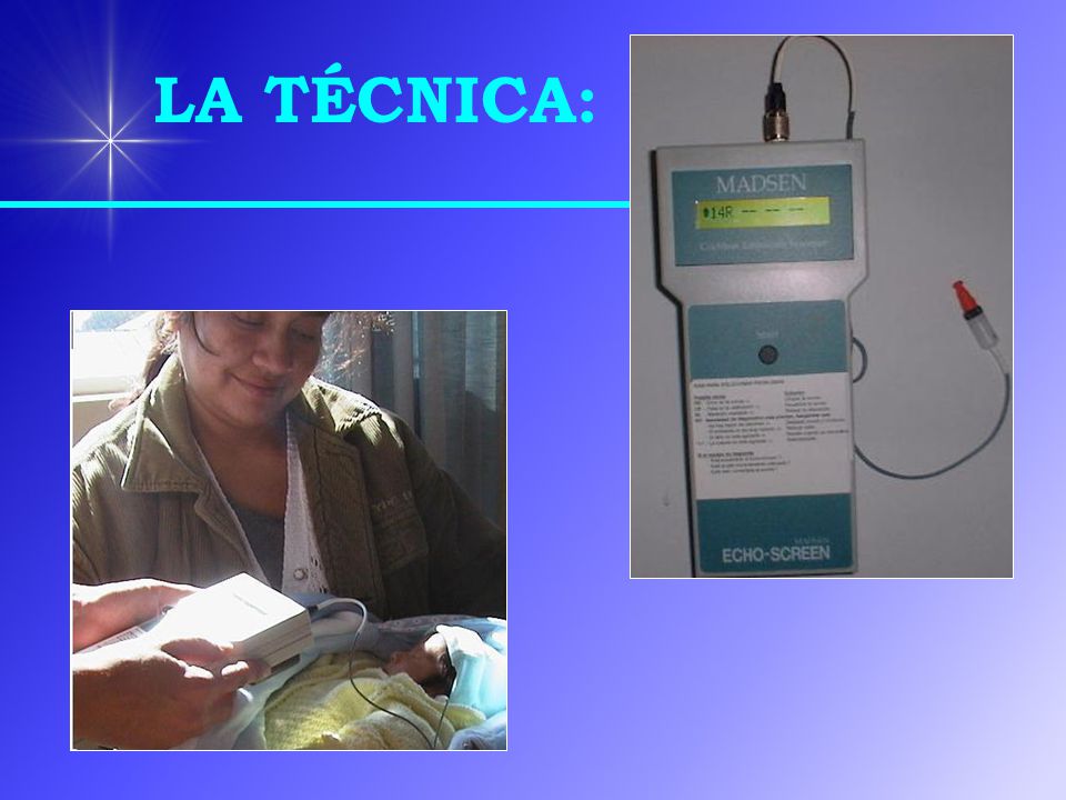 LA TÉCNICA: La tecnica consiste en introducir la oliva del equipo en el conducto auditivo externo del paciente.