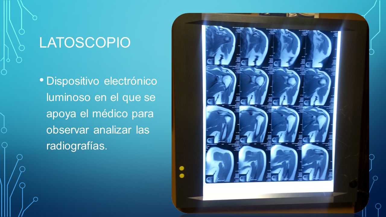 Latoscopio Dispositivo electrónico luminoso en el que se apoya el médico para observar analizar las radiografías.