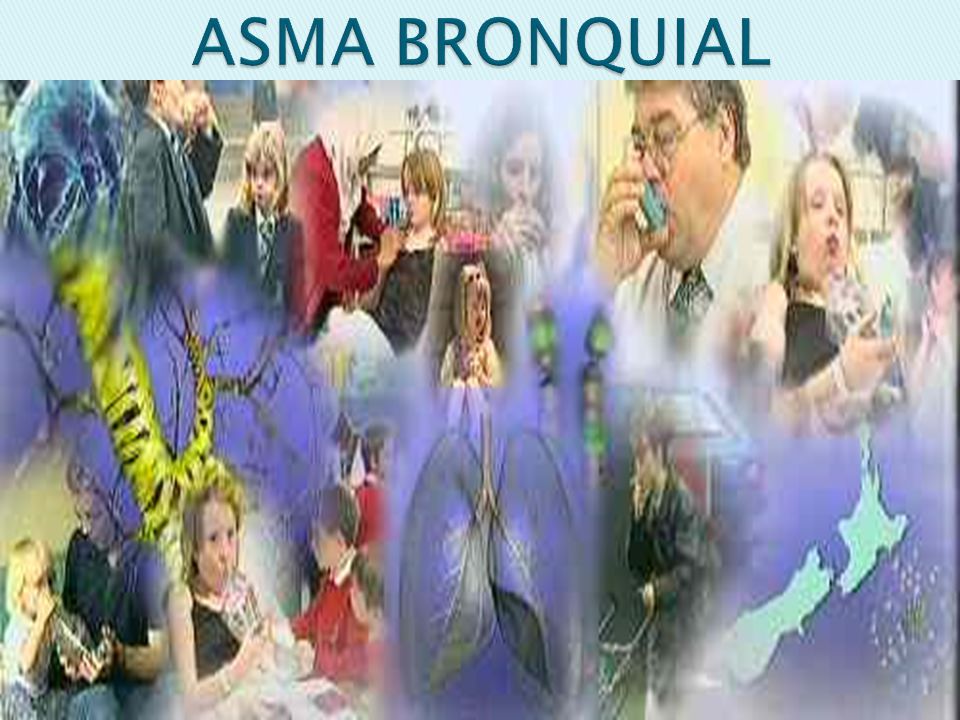 ASMA BRONQUIAL