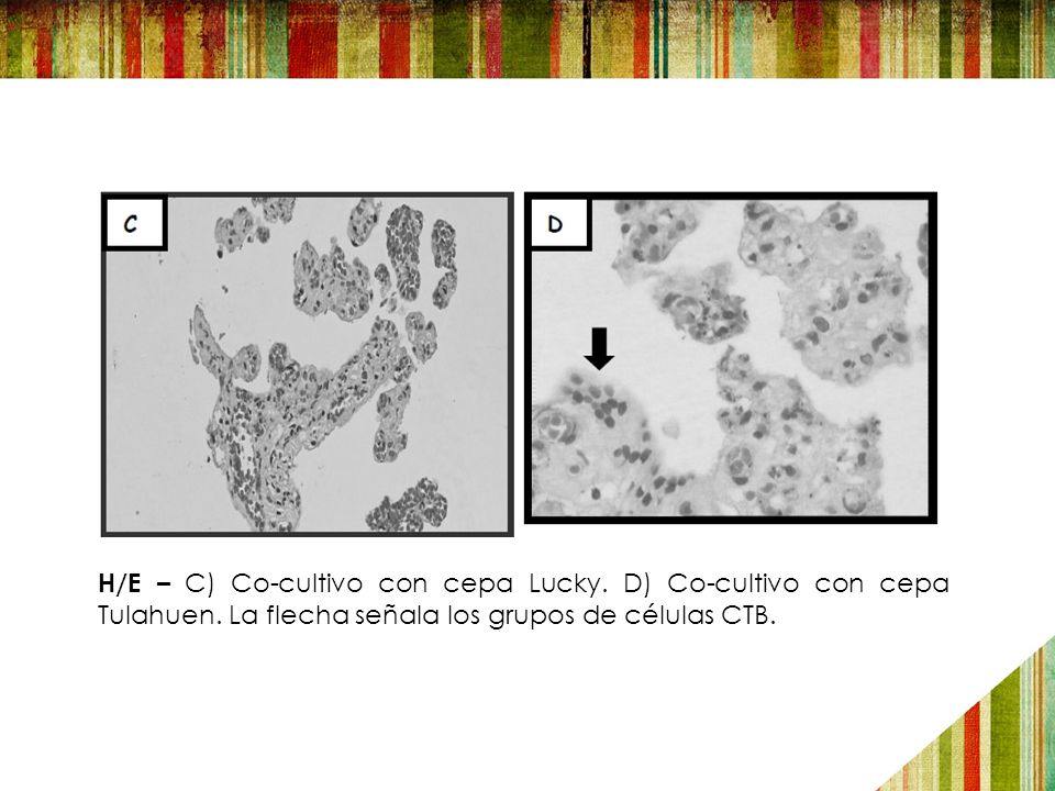 H/E – C) Co-cultivo con cepa Lucky. D) Co-cultivo con cepa Tulahuen