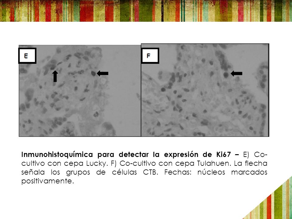 Inmunohistoquímica para detectar la expresión de Ki67 – E) Co-cultivo con cepa Lucky.