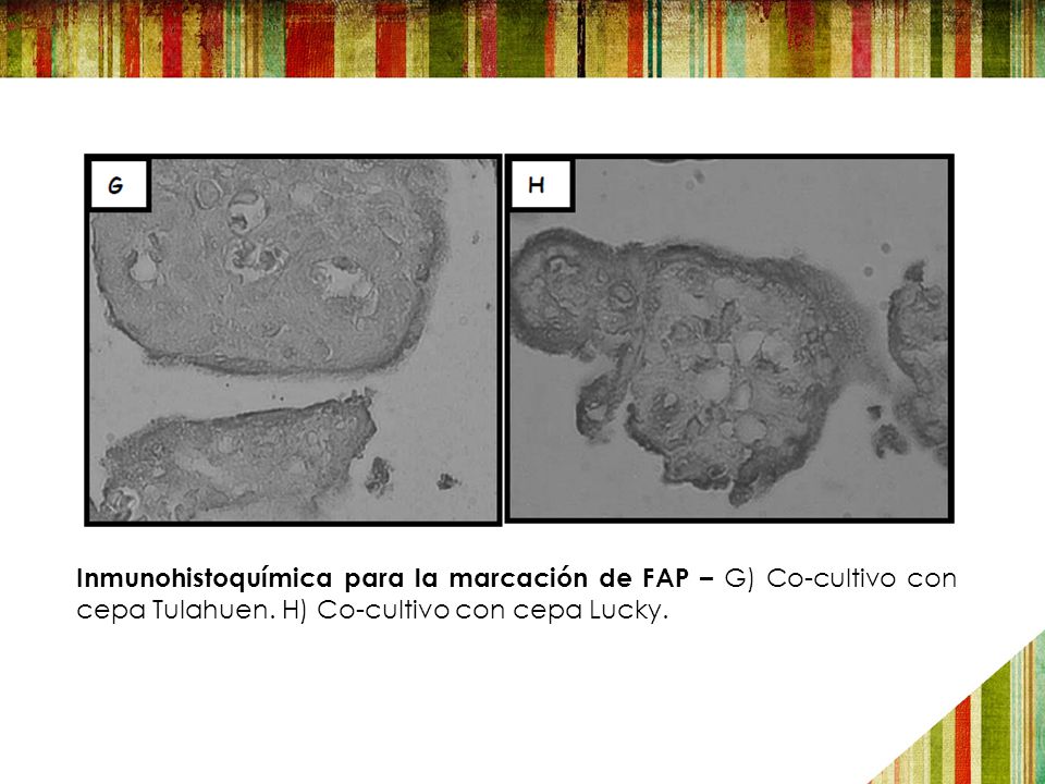 Inmunohistoquímica para la marcación de FAP – G) Co-cultivo con cepa Tulahuen.