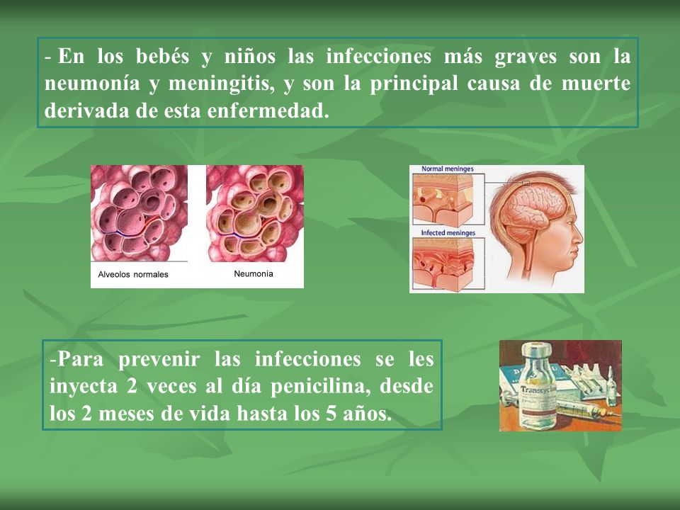 En los bebés y niños las infecciones más graves son la neumonía y meningitis, y son la principal causa de muerte derivada de esta enfermedad.