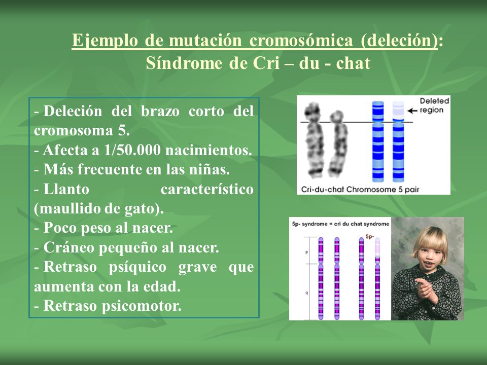 Ejemplo de mutación cromosómica (deleción): Síndrome de Cri – du - chat