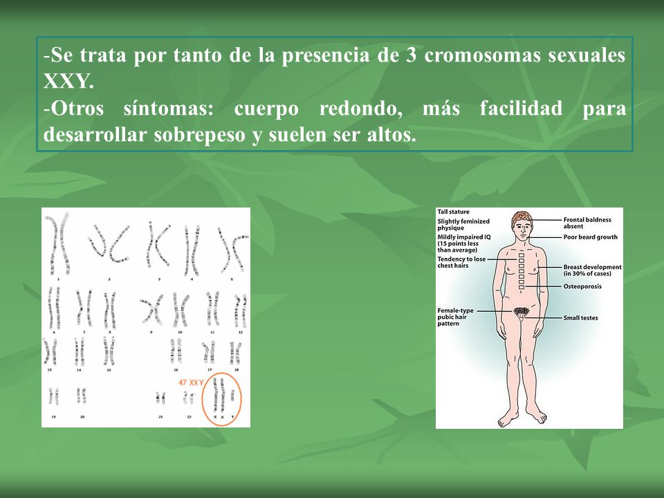 Se trata por tanto de la presencia de 3 cromosomas sexuales XXY.