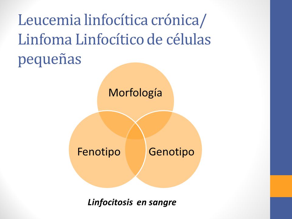 Leucemia linfocítica crónica/ Linfoma Linfocítico de células pequeñas