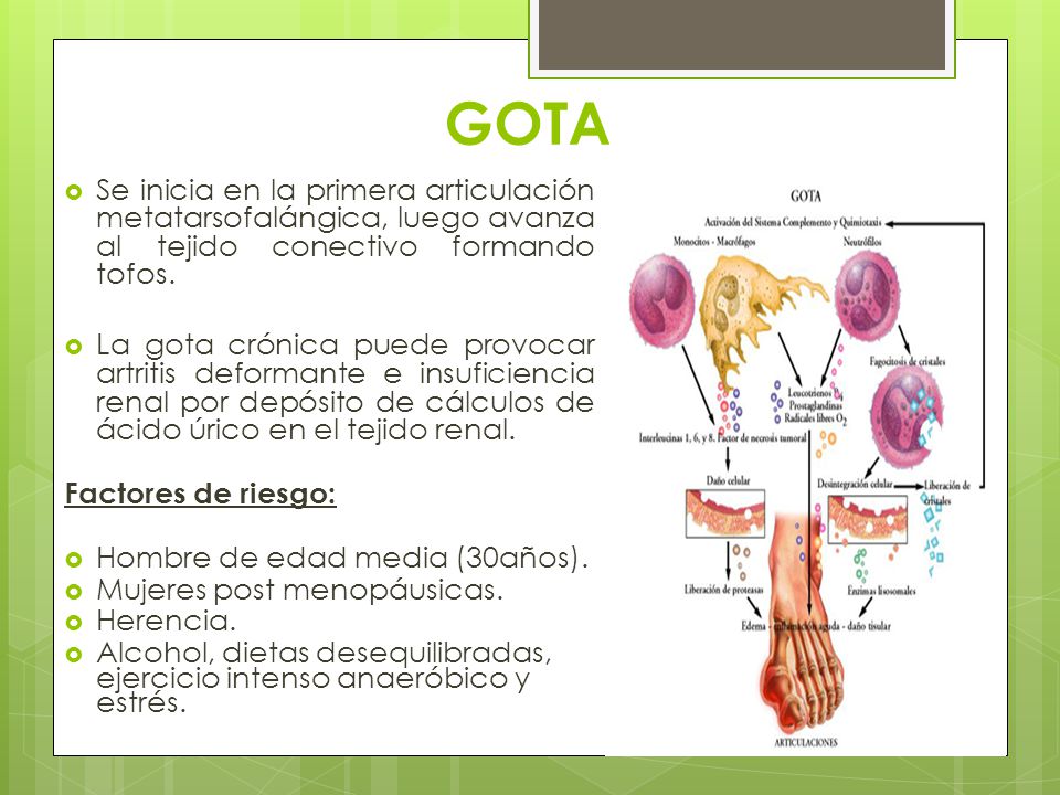 GOTA Se inicia en la primera articulación metatarsofalángica, luego avanza al tejido conectivo formando tofos.