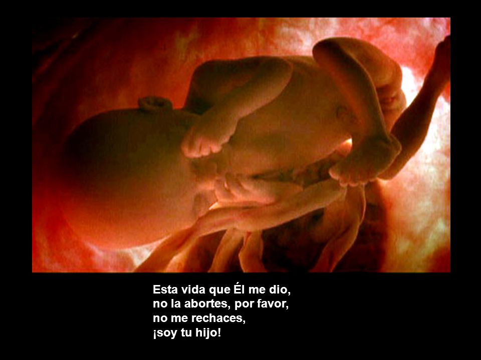 Esta vida que Él me dio, no la abortes, por favor, no me rechaces, ¡soy tu hijo!