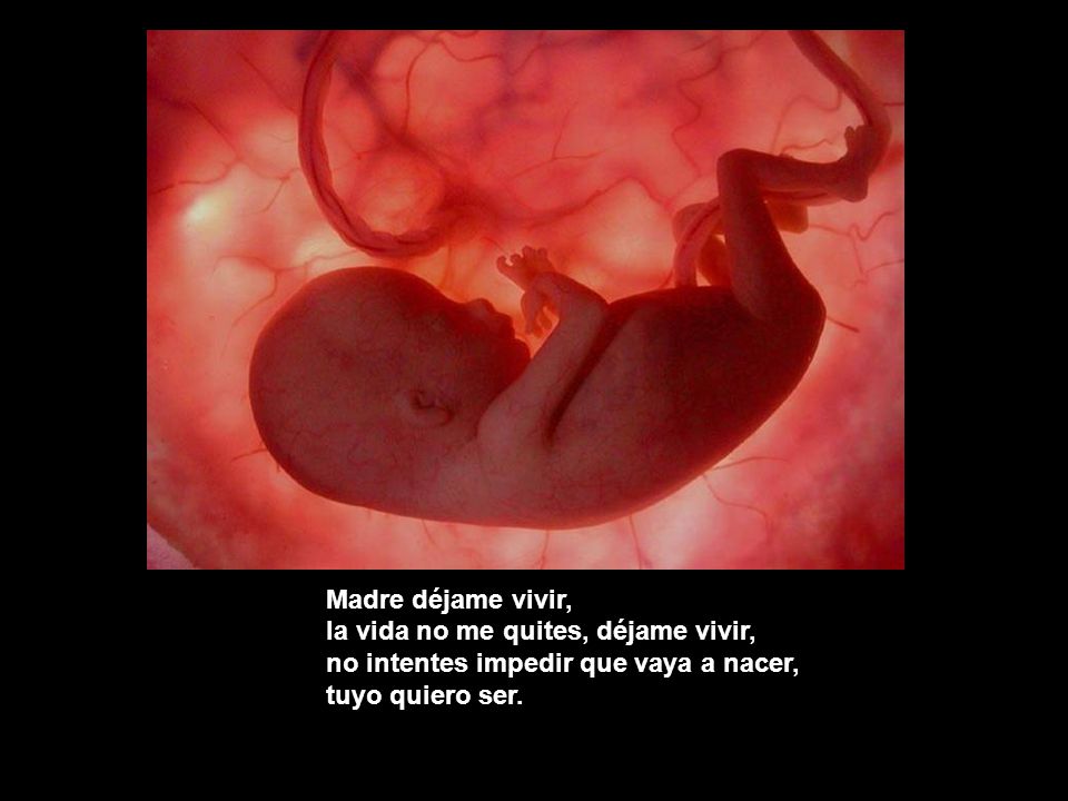 Madre déjame vivir, la vida no me quites, déjame vivir, no intentes impedir que vaya a nacer, tuyo quiero ser.