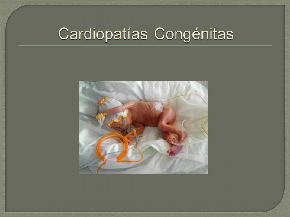 Cardiopatías Congénitas