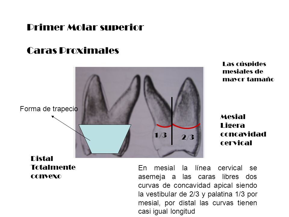 Primer Molar superior Caras Proximales Forma de trapecio Mesial
