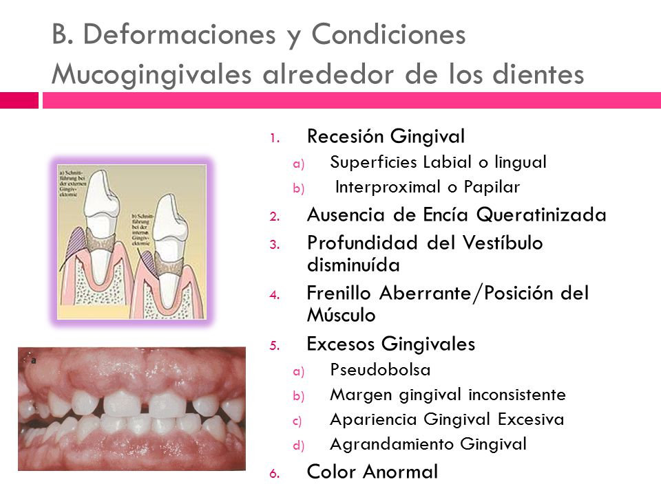 B. Deformaciones y Condiciones Mucogingivales alrededor de los dientes