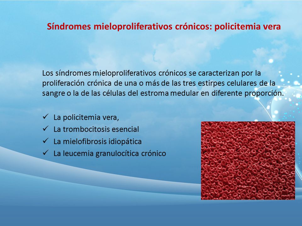 Síndromes mieloproliferativos crónicos: policitemia vera