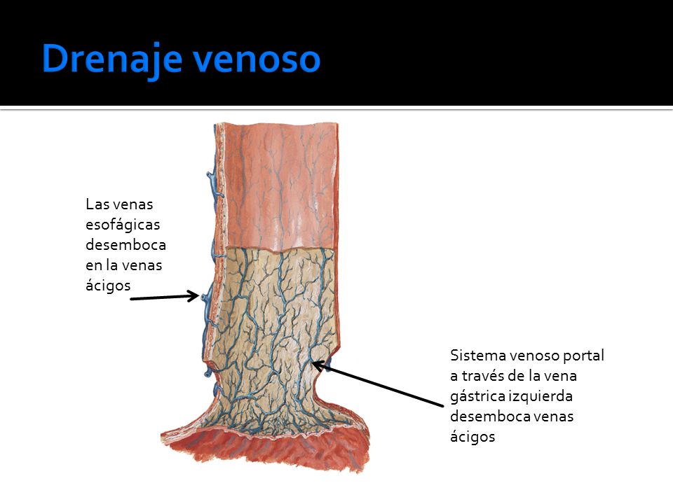 Drenaje venoso Las venas esofágicas desemboca en la venas ácigos