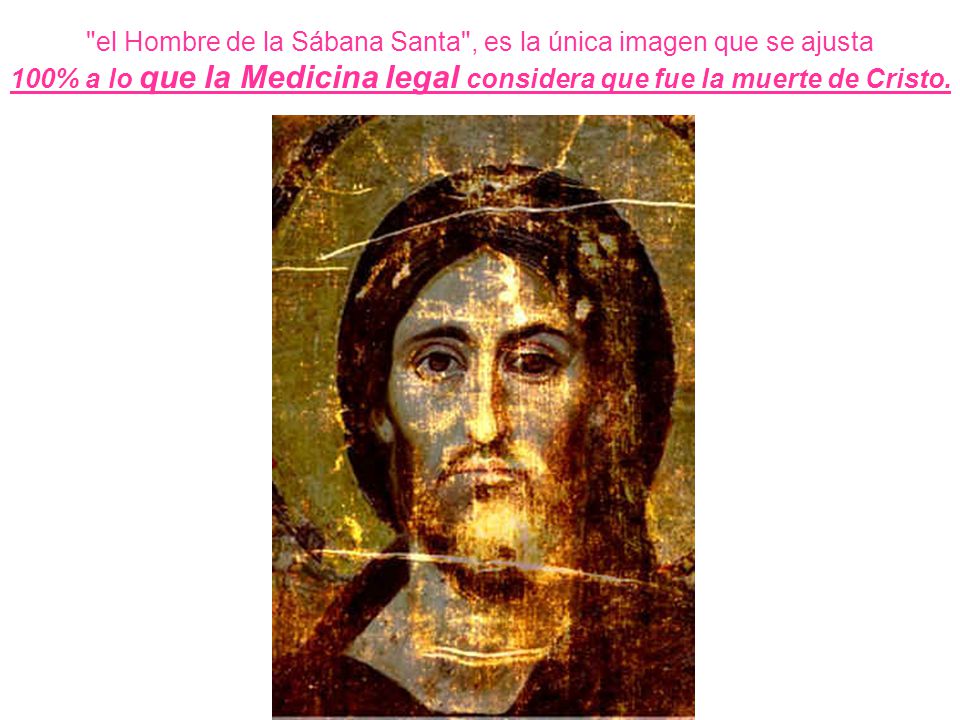 el Hombre de la Sábana Santa , es la única imagen que se ajusta 100% a lo que la Medicina legal considera que fue la muerte de Cristo.