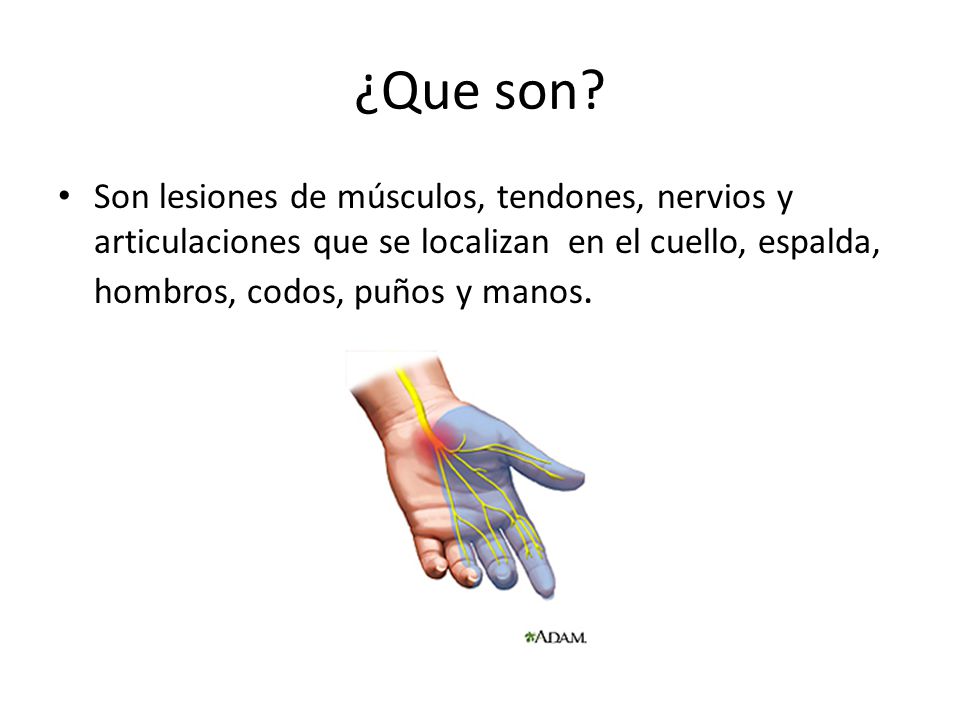 ¿Que son.