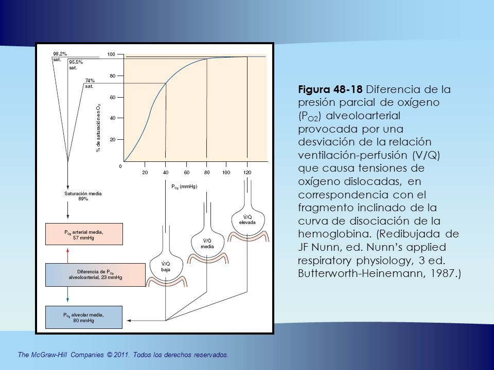 Figura Diferencia de la presión parcial de oxígeno (PO2) alveoloarterial provocada por una desviación de la relación ventilación-perfusión (V/Q) que causa tensiones de oxígeno dislocadas, en