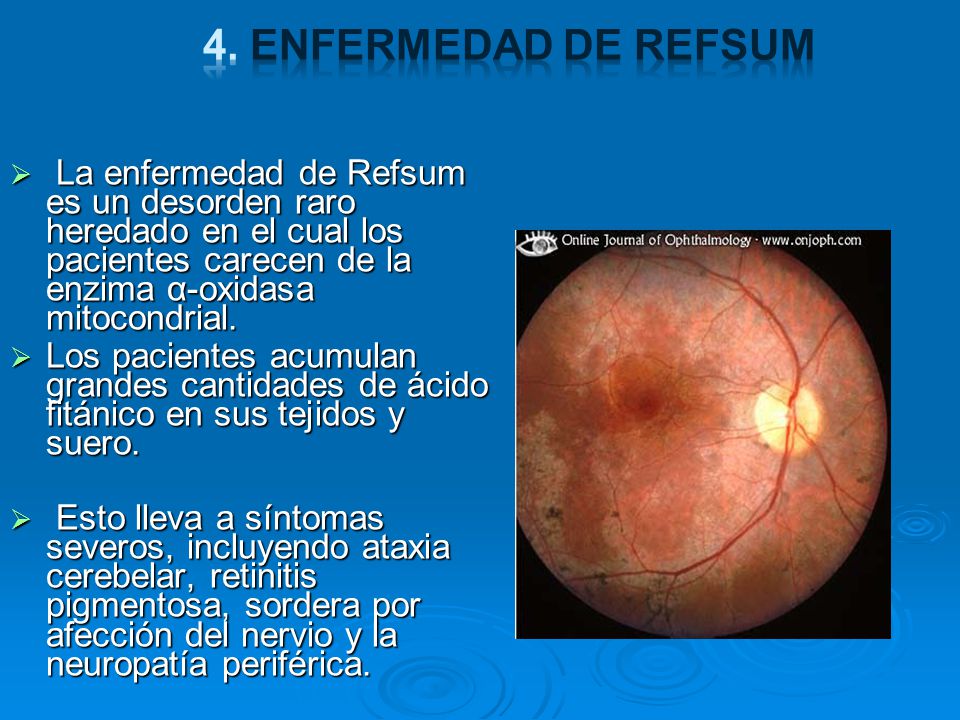4. Enfermedad de Refsum La enfermedad de Refsum es un desorden raro heredado en el cual los pacientes carecen de la enzima α-oxidasa mitocondrial.